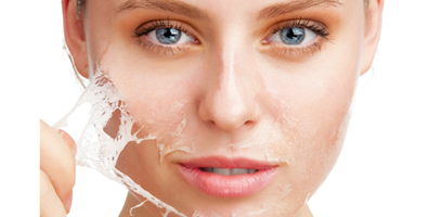 Chemical-Peel-Treatment