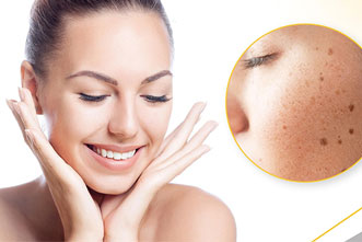 Best Skin Care Clinic in Andheri